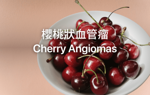 cherry angiomas